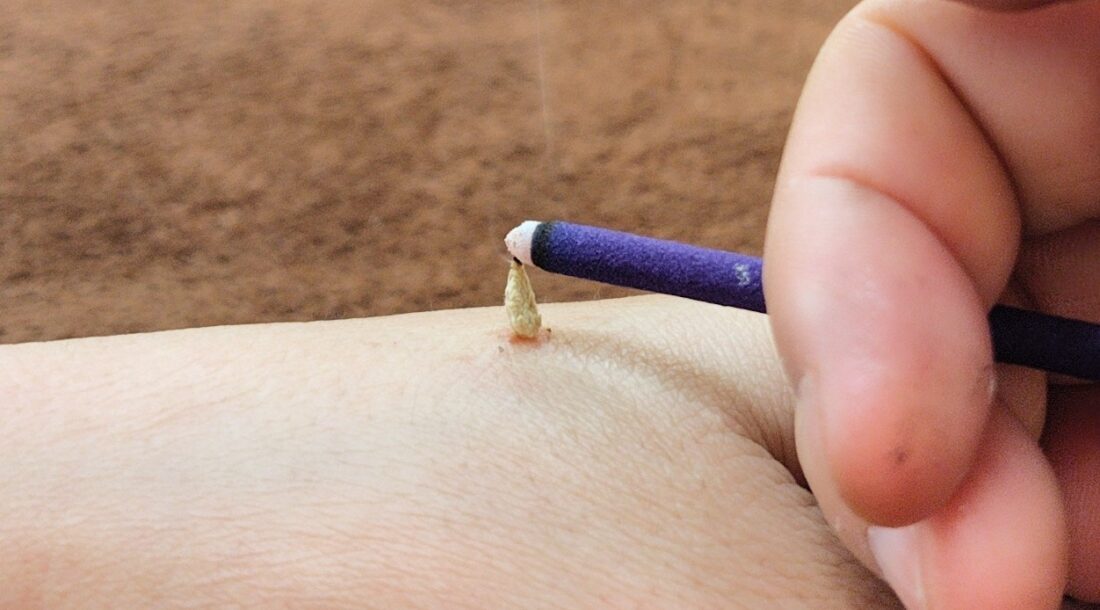 お灸のリラックス効果